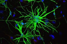 astrocyte-cells.jpg