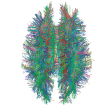 White_Matter_Connections_Obtained_with_MRI_Tractography.png