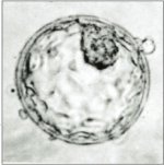 Human_blastocyst.jpg