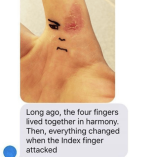 the four fingers.png