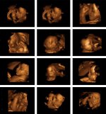 3D-4D-Ultrasound-Baby-Pictures.jpg