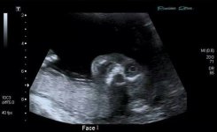 weird-ultrasound-1.jpg