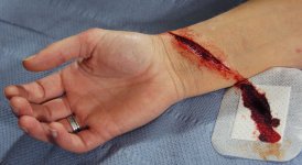 cut_wrist_prosthetic__68650_1361370904_1280_1280.jpg