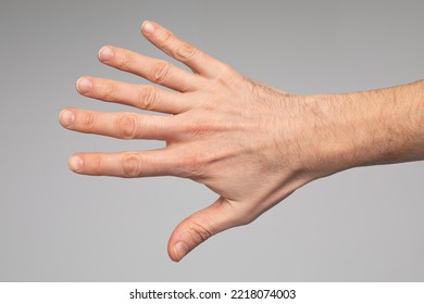 case-polidactyly-close-hand-man-260nw-2218074003.jpg