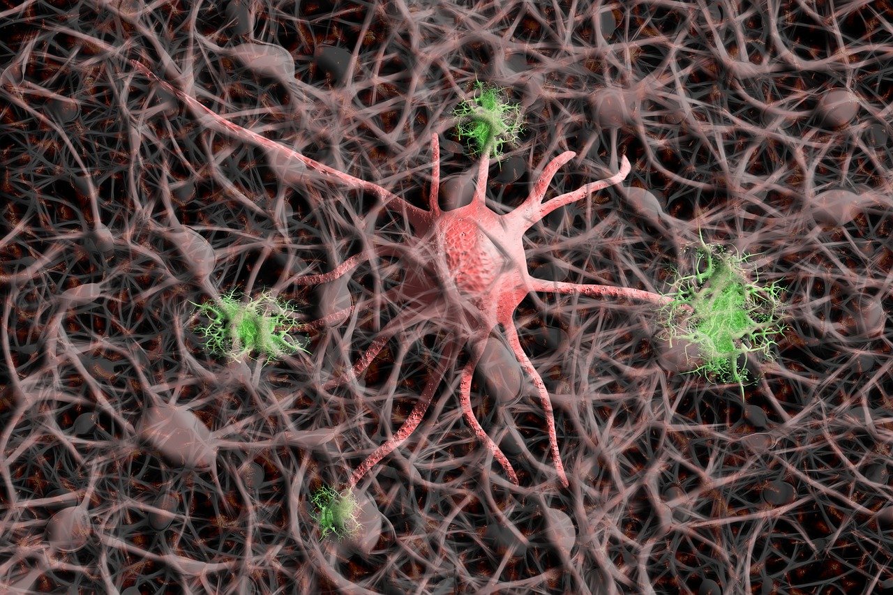 nerve-cells-5901770_1280.jpg