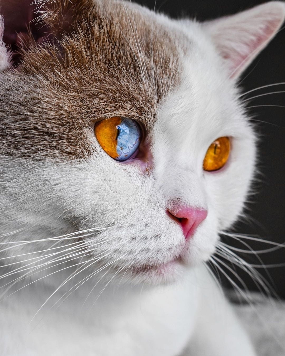 Sectoral-heterochromia.jpeg