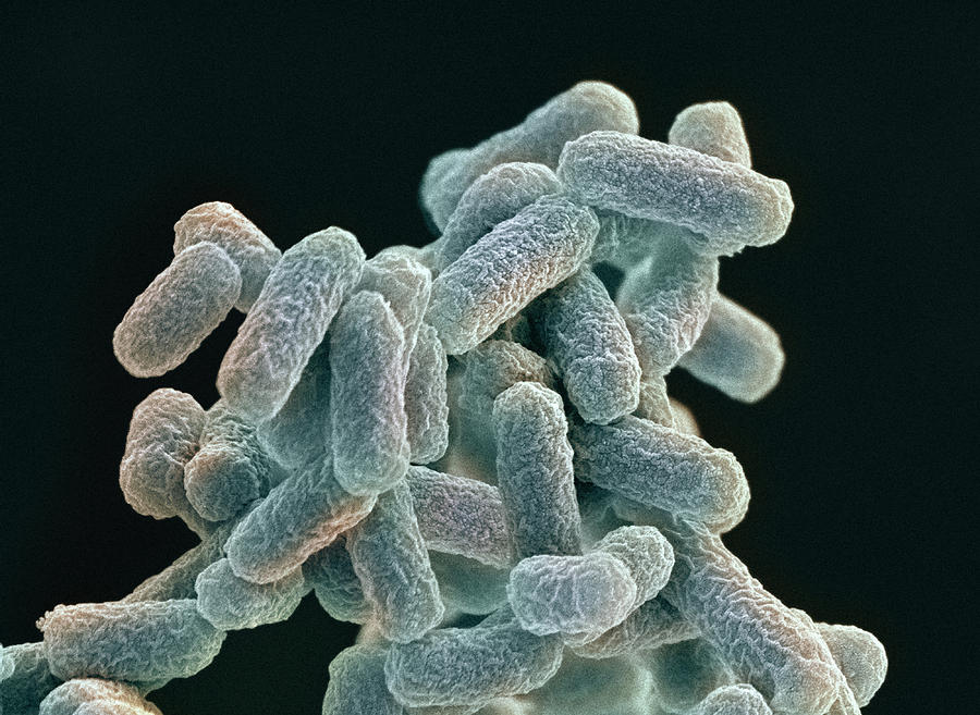14-e-coli-bacteria-sem-steve-gschmeissner.jpg